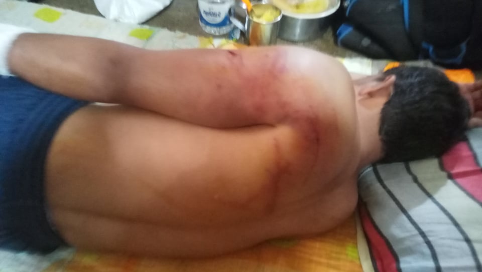 Uttara-EPZ-worker-beaten-and-injured.jpg